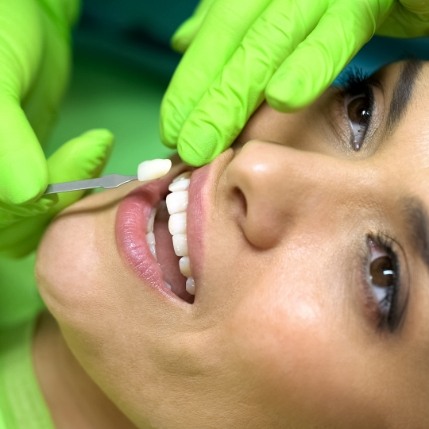 Woman receiving a veneer for her tooth from cosmetic dentist in Marion