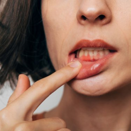 Lady shows off gum tissue